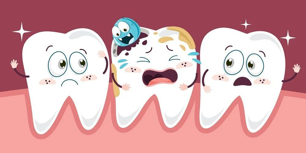 Sâu răng sữa và những điều cần biết