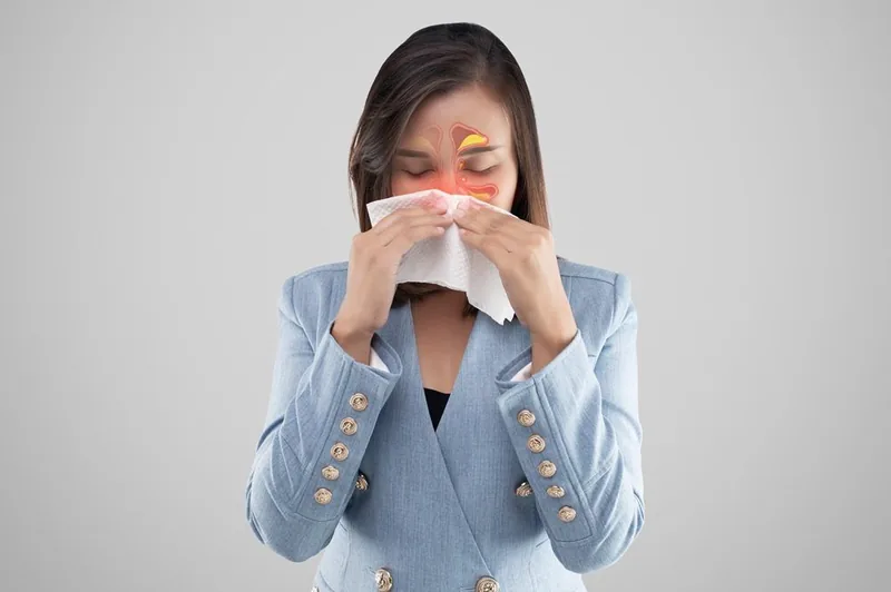 Viêm xoang cấp tính, mãn tính